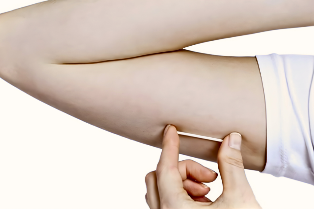 Implanon at Retro Med Care